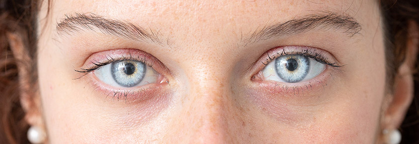 Augen Retinopathie