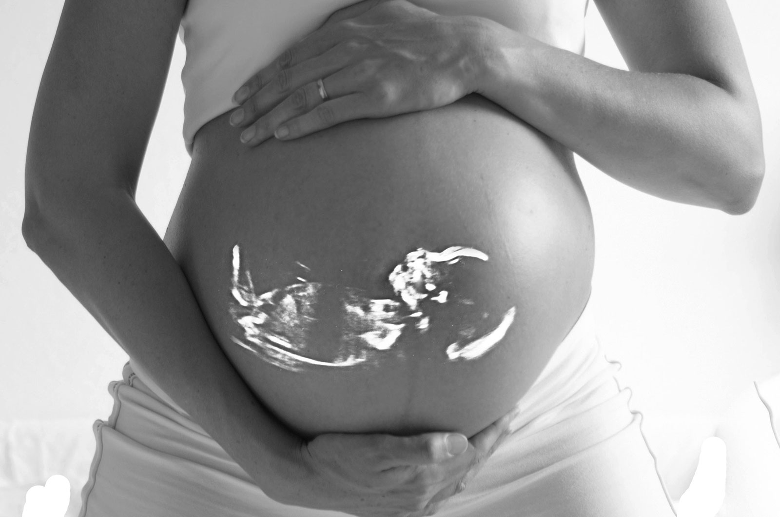 schwangere Frau mit Lage des Babys, Darstellung im Ultraschallbild