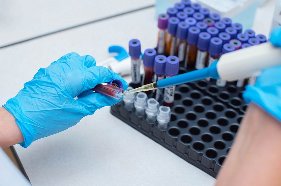 Mann mit Diabetes Typ 1 braucht